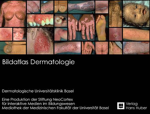 Bild atlas Dermatology97